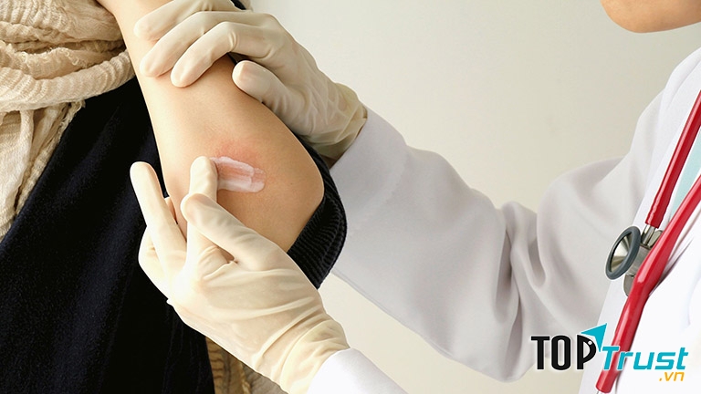 Kem bôi trị nấm da Dipolac G