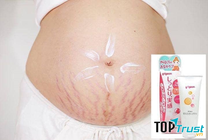 Kem đặc trị và ngăn ngừa rạn da, căng da Pigeon nội địa Nhật Bản