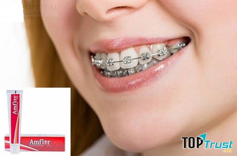 kem đánh răng Amflor ngăn ngừa mảng bám bằng việc thâm nhập sâu trong không gian kẽ răng