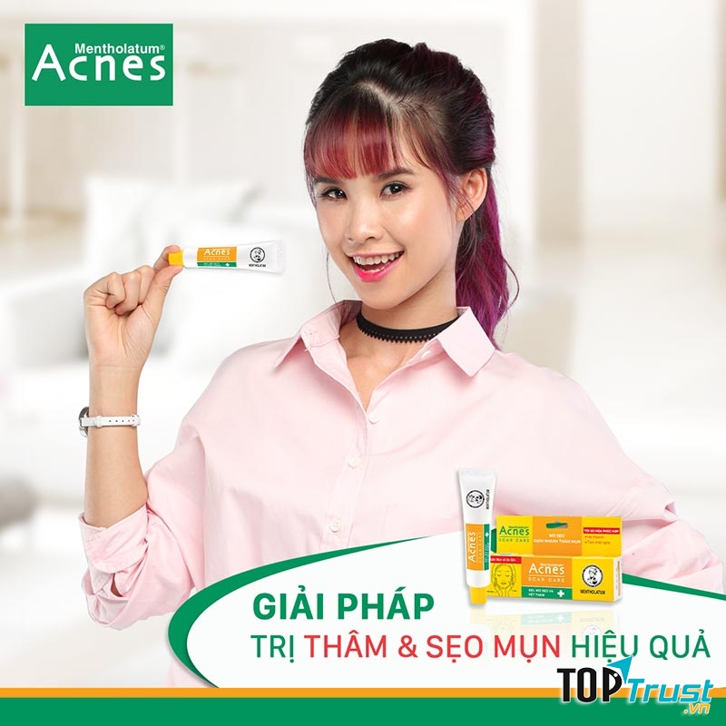 Kem nghệ trị mụn Acnes Scar Care