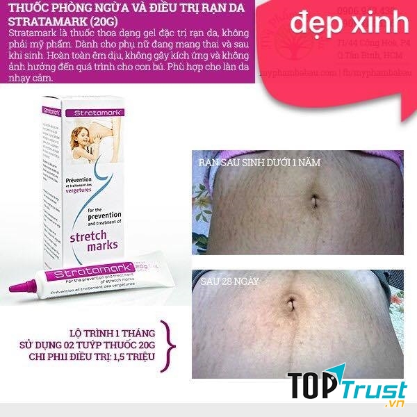 Kem phòng ngừa và điều trị rạn da Stratamark