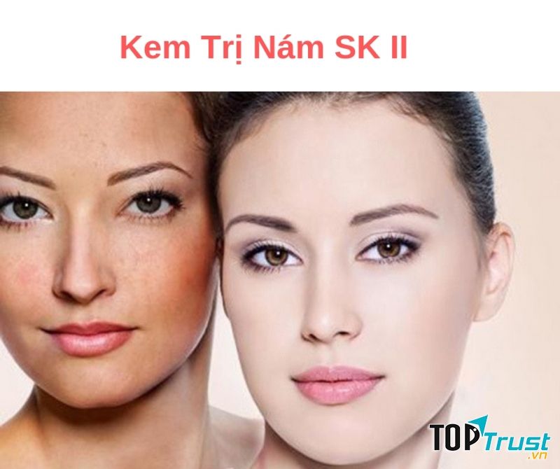 Whitening Source Derm Brightener giúp làm giảm các vết thâm nám trên da hiệu quả.