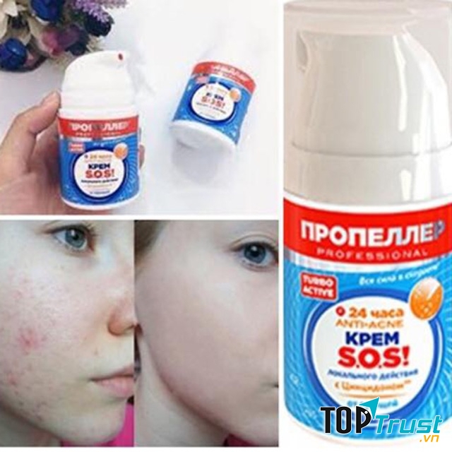 Kem trị sẹo Anti-scar Propeller SOS Cream Russia