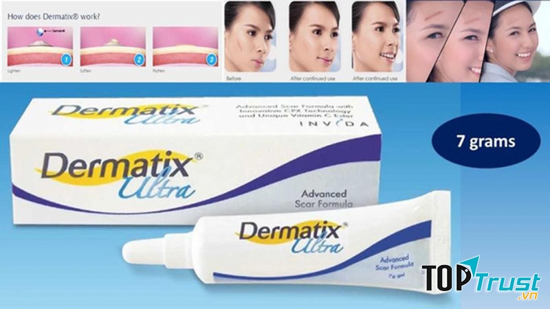 Kem trị sẹo Dermatix Ultra