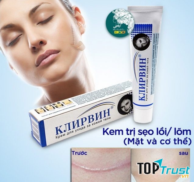 Kem Trị Sẹo Klirvin