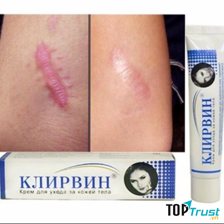 Kem Trị Sẹo Klirvin