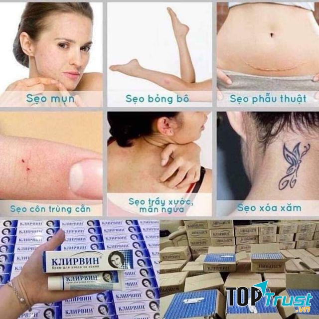 Kem trị sẹo Nga Kjinpbnh