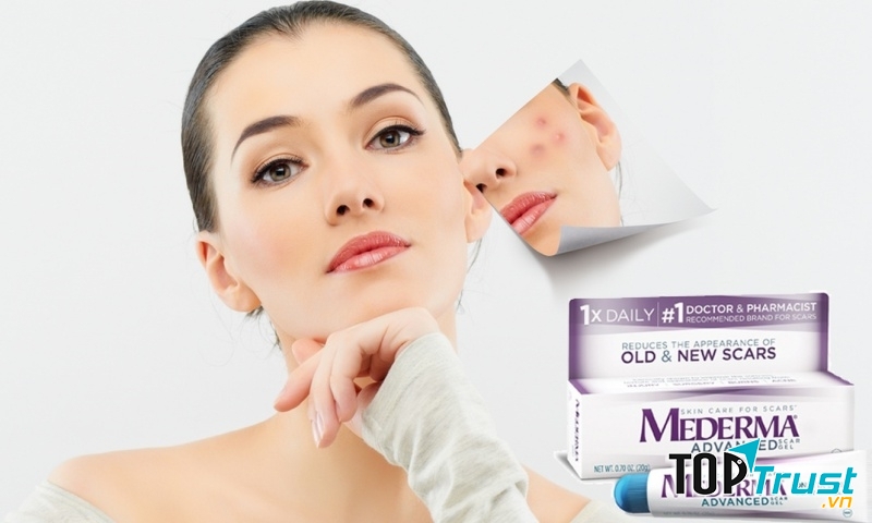 Kem trị sẹo Mederma
