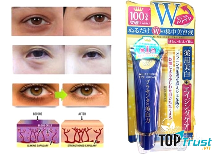 Kem trị thâm mắt Meishoku Whitening Eye Cream