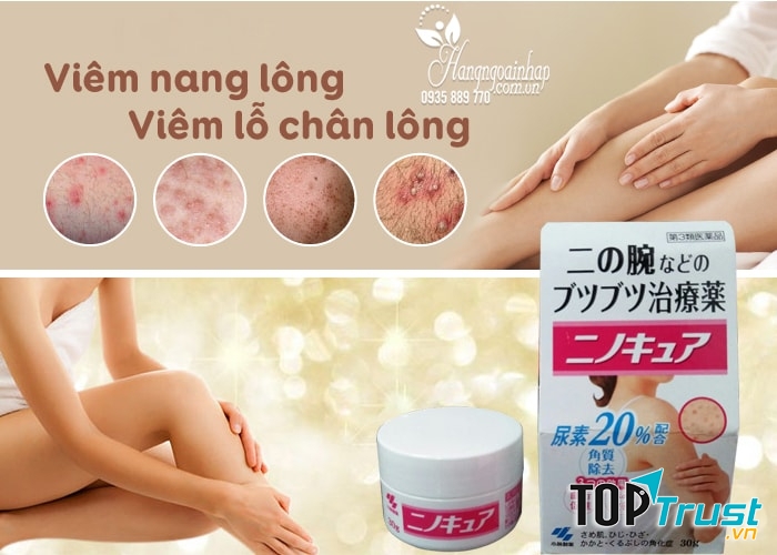 Kem trị viêm nang lông Kobayashi của Nhật giúp giảm sưng viêm, lưu thông máu, giảm sừng thô cứng ở các vùng như cánh tay, chân, đùi gây mất tự tin và thẩm mỹ
