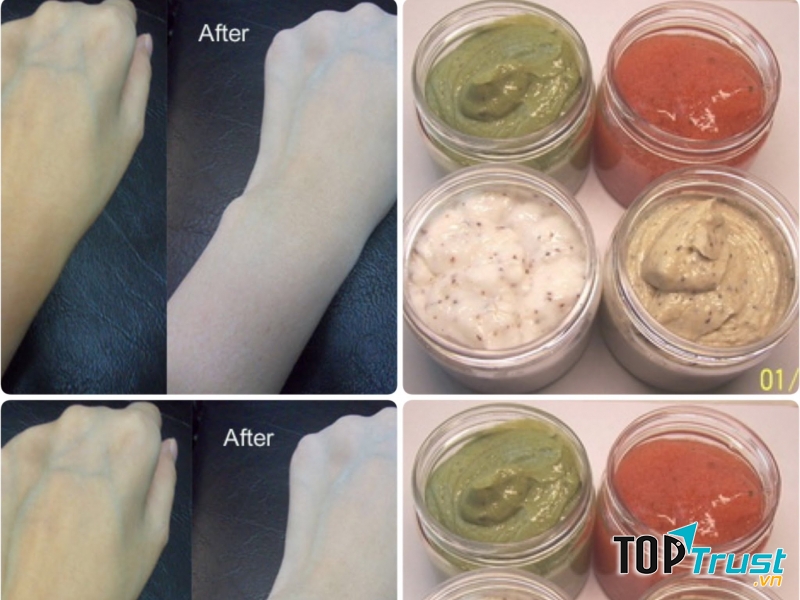 Một khi đã để da chịu tác động của kem trộn, bạn sẽ rất khó để phục hồi tình trạng da trước đây.