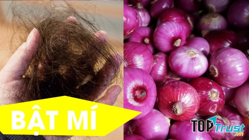 Khắc phục rụng tóc tại nhà bằng nước ép hành tây