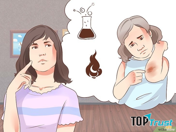 Với những vết bỏng nặng, cha mẹ nên nhanh chóng đưa trẻ đến các cơ sở y tế.