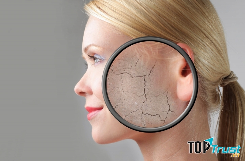 Hút thuốc lá khiến da trở nên thô ráp