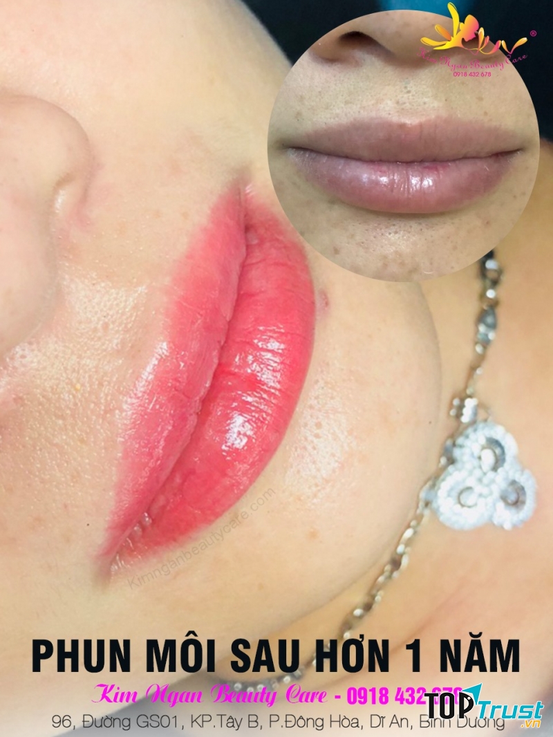 Kim Ngân Beauty Care