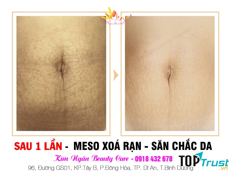 Kim Ngân Beauty Care