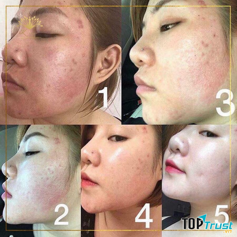 Kim Spa