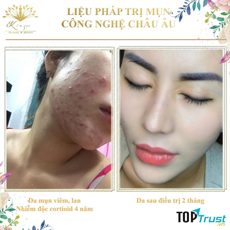 Kim Spa