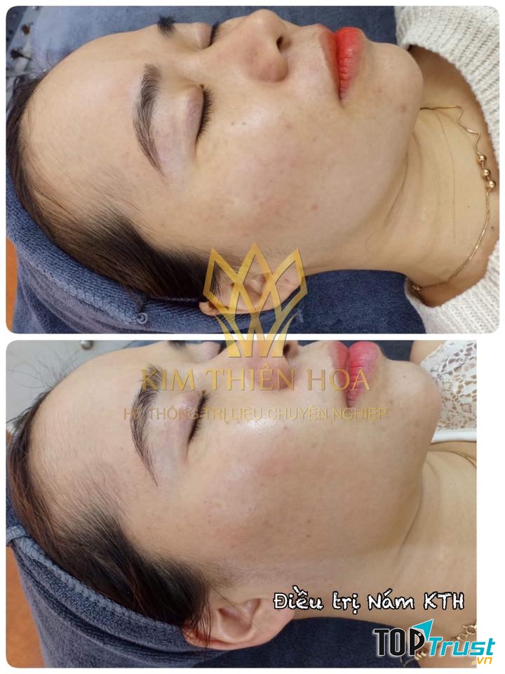 Kim Thiên Hoa Spa