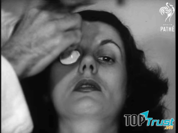 Kính áp tròng ngày trước