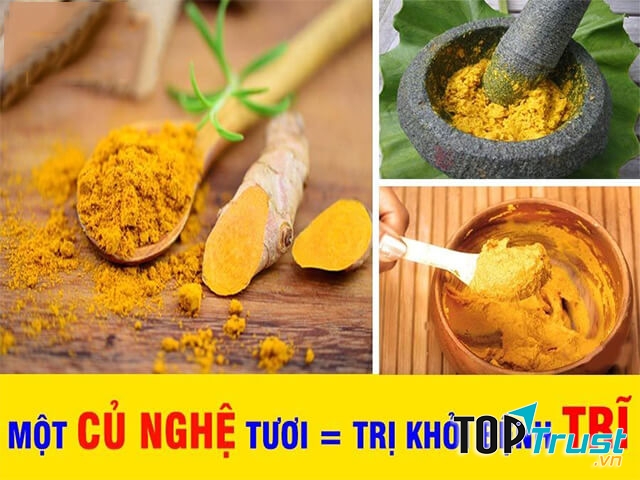 Kinh nghiệm chữa bệnh trĩ từ củ nghệ