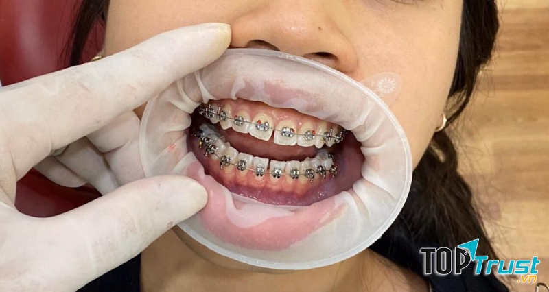Klava Smart Dental