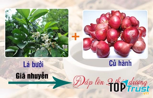 Lá bưởi kết hợp cùng củ hành, đắp lên thái dương sẽ chống đau đầu, chóng mặt, căng thẳng.