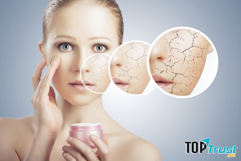 La Roche Posay là sản phẩm dưỡng ẩm tốt nhất cho da khô