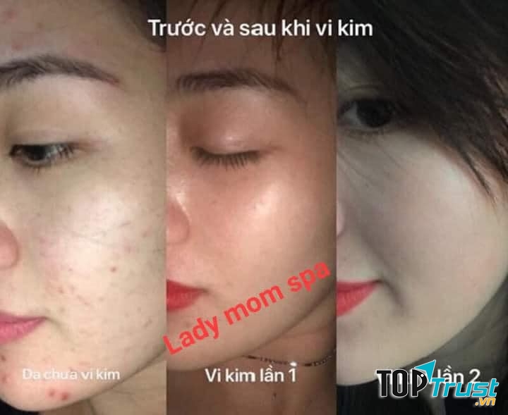 Lady Mom Spa