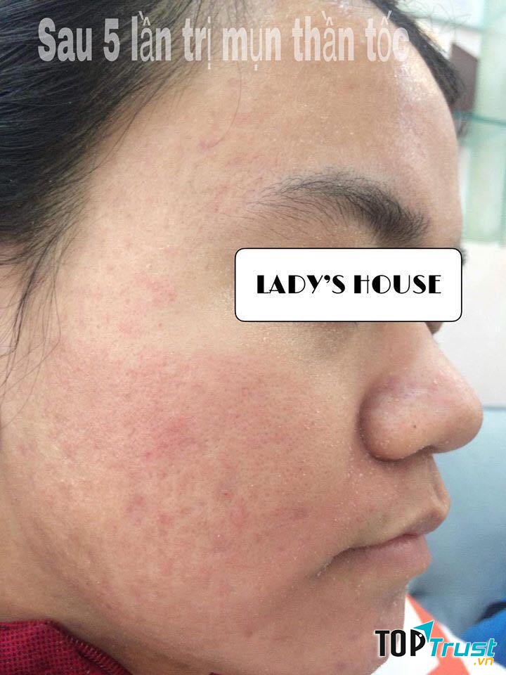 Lady's House - Spa Bình Dương K8
