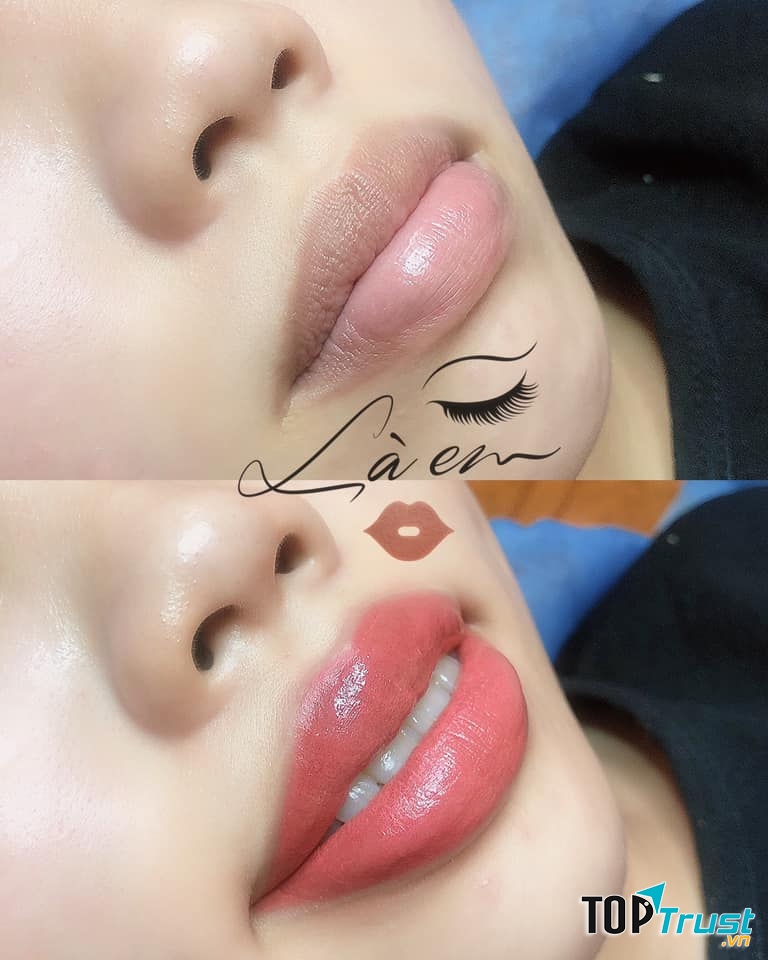 LAEM