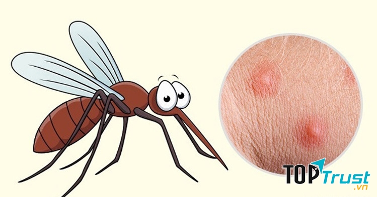 Làm giảm vết côn trùng cắn