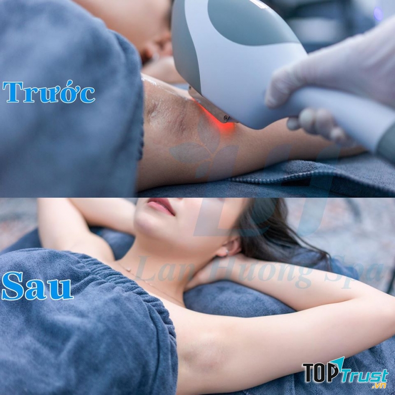 Lan Hương Spa