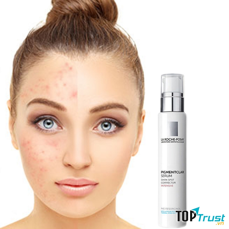 Laroche Posay Pigmentclar Serum Anti-tache