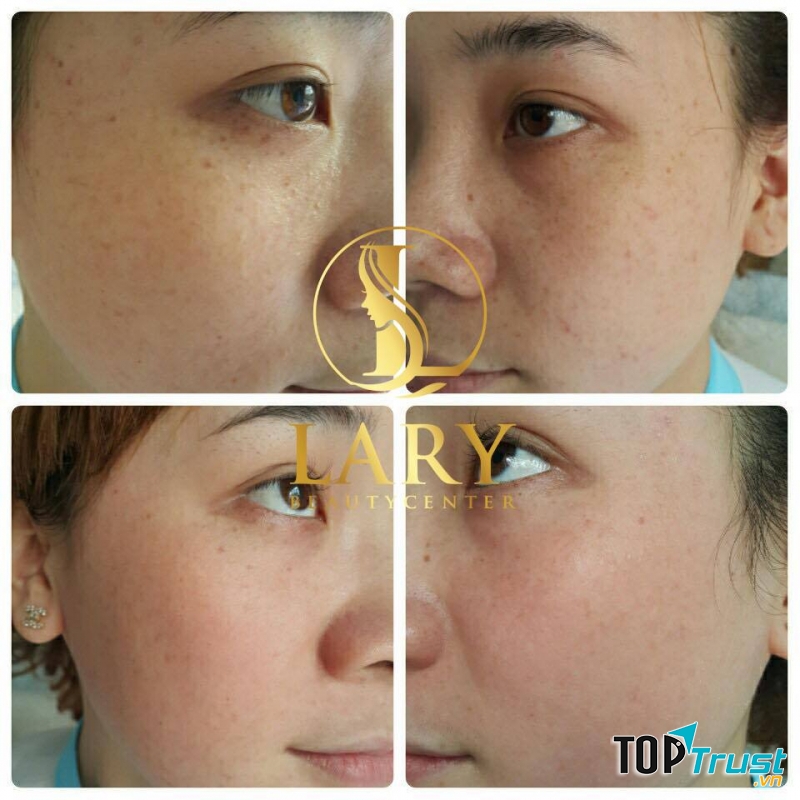 Lary Beauty & Spa