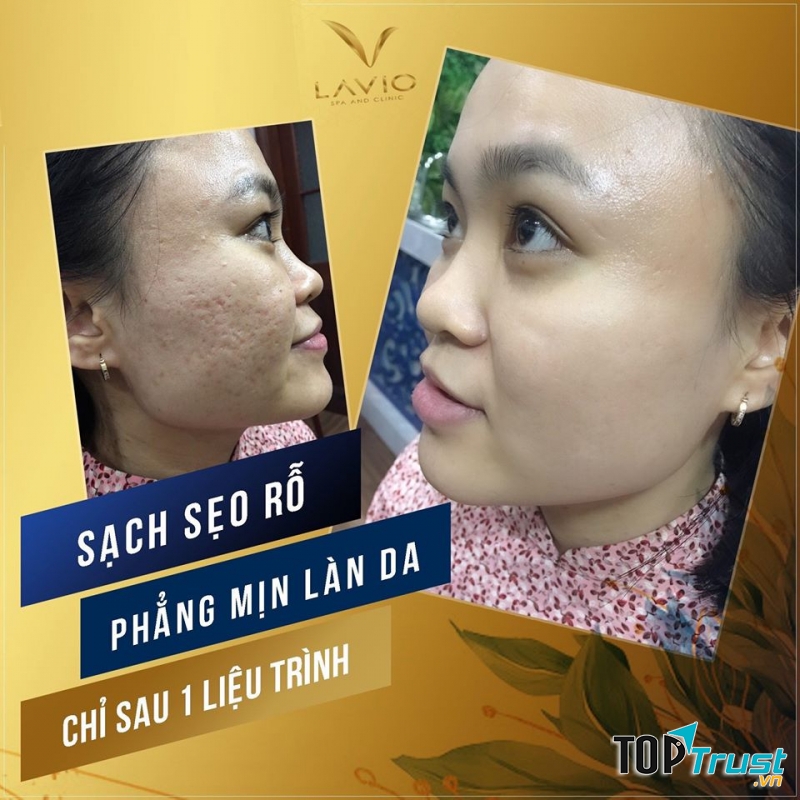LAVIO Spa & Clinic Cần Thơ
