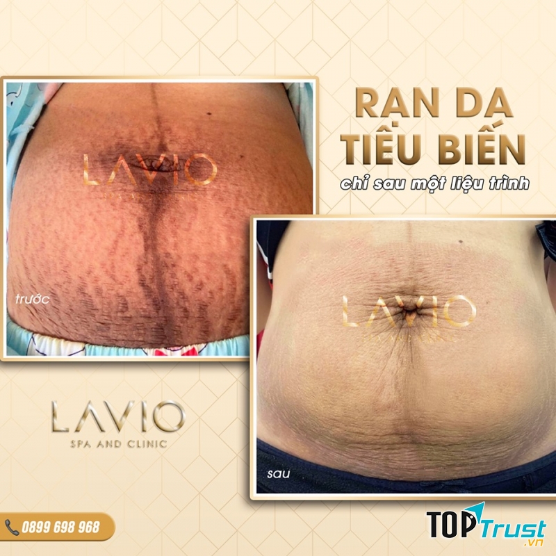 LAVIO Spa & Clinic Cần Thơ