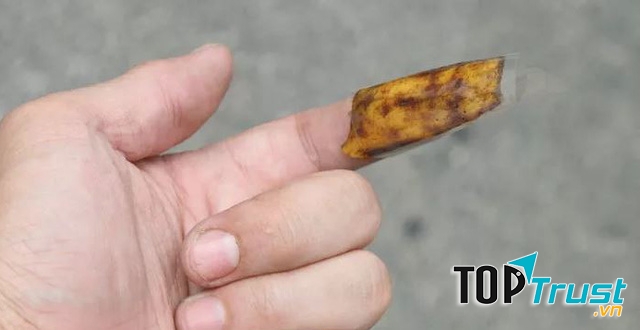 Lấy dằm ra khỏi tay