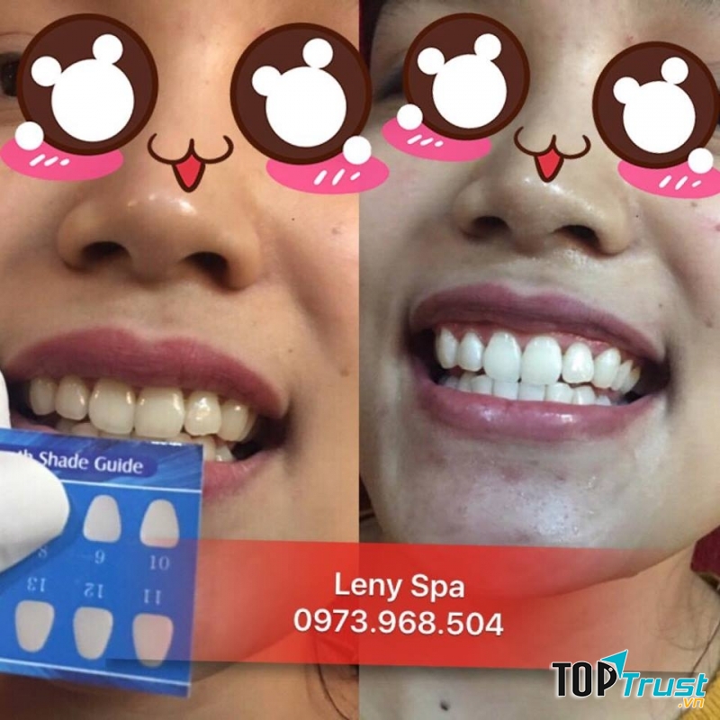 Khách đến trải nghiệm dịch vụ tại Leny Spa