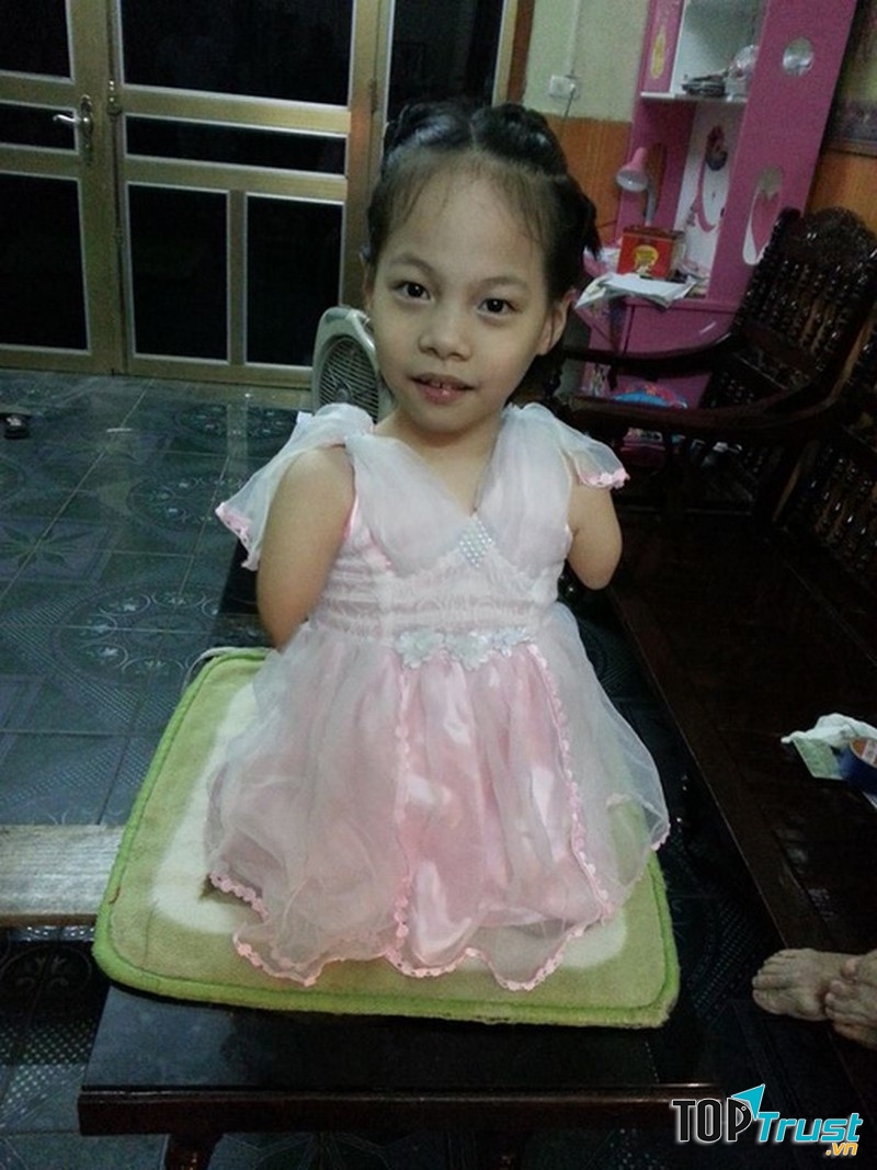 Linh Chi: “Nick Vujicic” Việt Nam