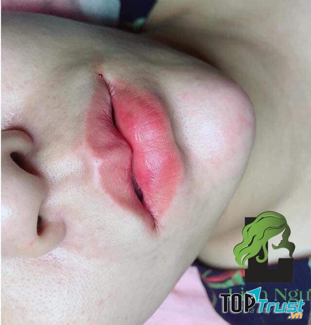 LINH NGƯ - Beauty & Spa
