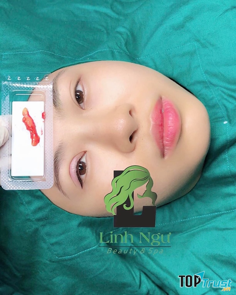 LINH NGƯ - Beauty & Spa