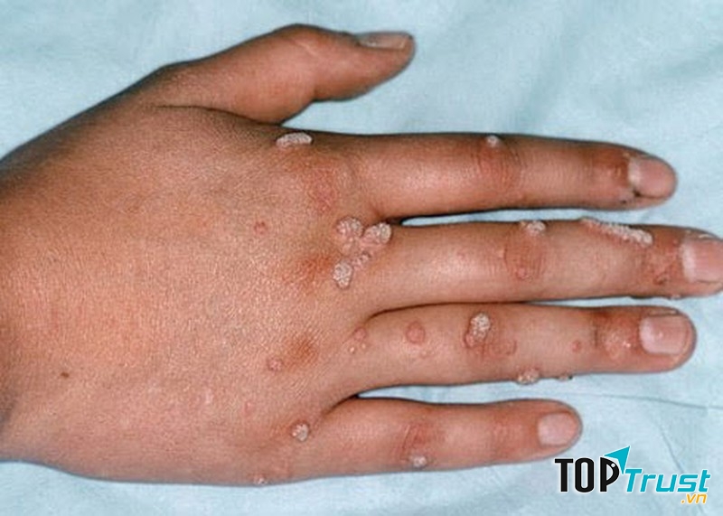 Ảnh minh họa - nguồn internet