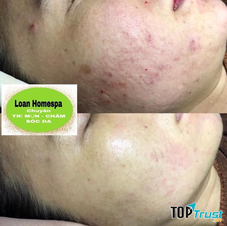 Loan Homespa