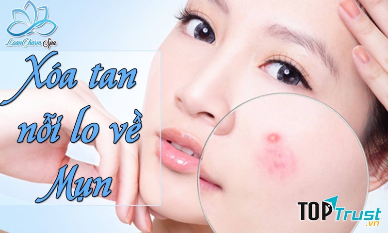 LoanCharm Spa