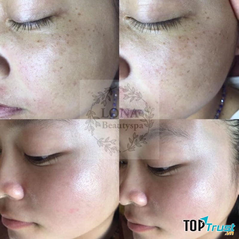 Lona Beauty Spa