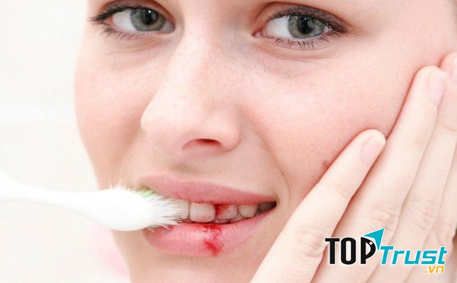 Ảnh minh họa - nguồn internet