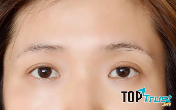 Lông mày thưa dần đi