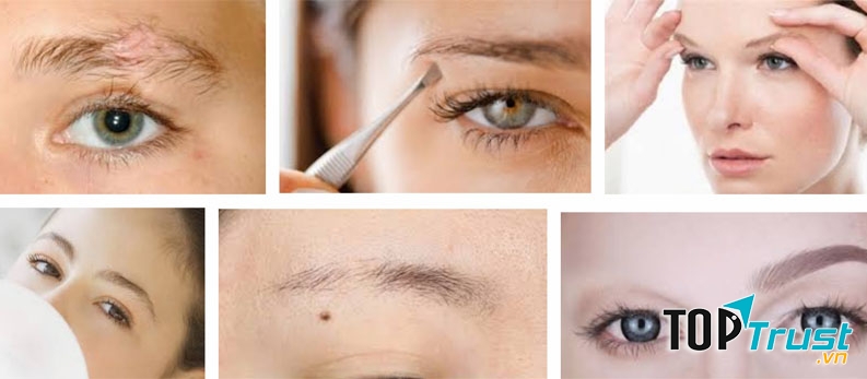 Lông mày cũng giống như tóc, nó phản ánh sức khỏe một cách rõ ràng và chân thực nhất.