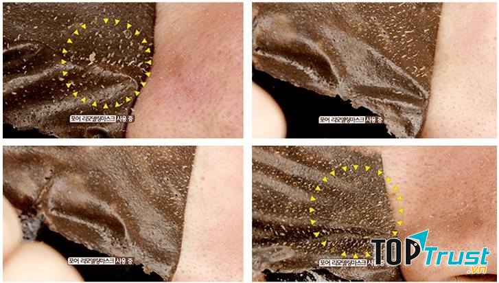 Hiệu quả Mặt nạ lột mụn Thần thánh Pore Clear Pad Pore Cleansing Mask